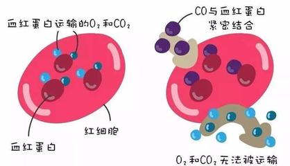 警惕洗澡季隱形殺手 一氧化碳中毒康復后，當心遲發性腦病